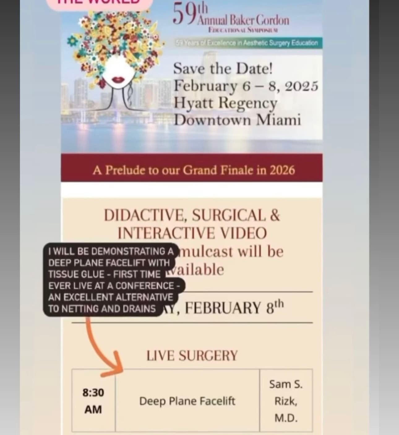Poster featuring Dr. Rizk's live surgery demonstration schedule at the 2025 Baker Gordon Symposium