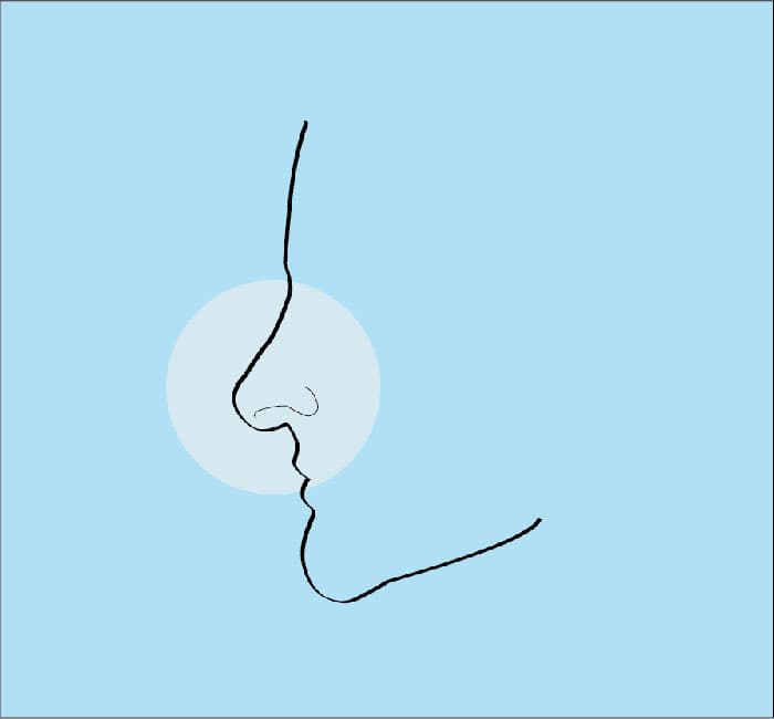 Droopy Nose