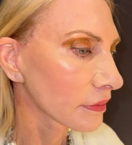 man photo Challenging Revision Surgery at 60