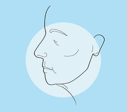 Common Face Concerns: Loss of Facial Volume