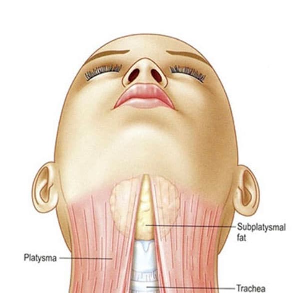 neck diagramm photo