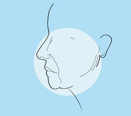 Common Face Concerns: Loose Skin on the Face