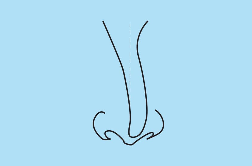 What Is Considered a Big Nose?